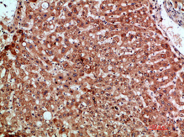 CSB-PA389153