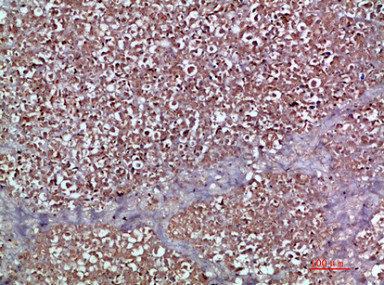 CSB-PA389153