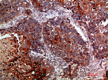 CSB-PA612015