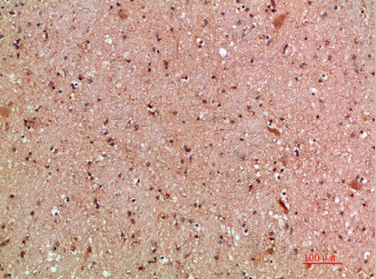 CSB-PA612015