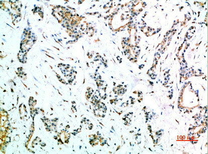 CSB-PA936888