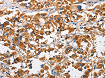 CSB-PA037884
