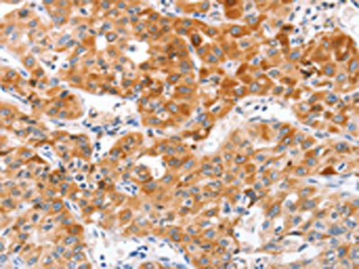 CSB-PA047815