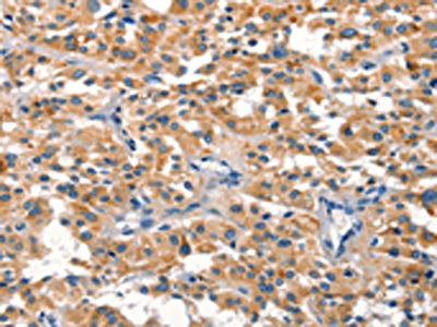 CSB-PA094054