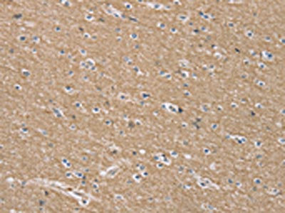 CSB-PA104885