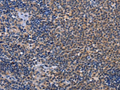 CSB-PA105485