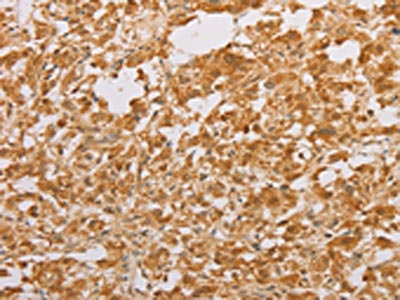 CSB-PA112765