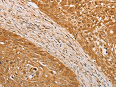 CSB-PA112765
