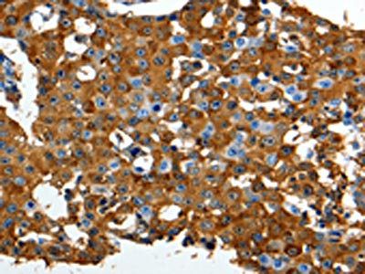 CSB-PA129534