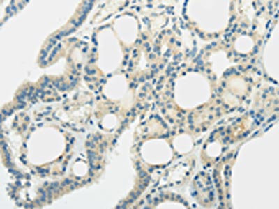 CSB-PA145393