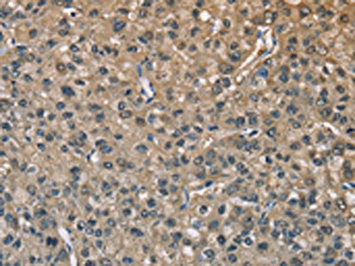 CSB-PA205920