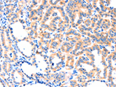CSB-PA206082