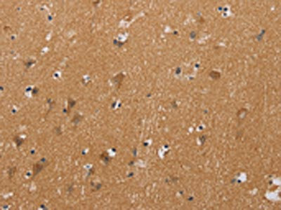 CSB-PA215866