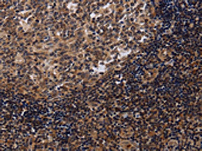 CSB-PA248105