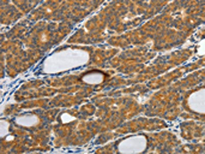 CSB-PA268599 IHC