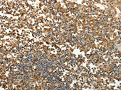 CSB-PA924520