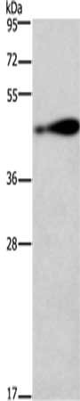 CSB-PA066696