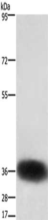 CSB-PA068714