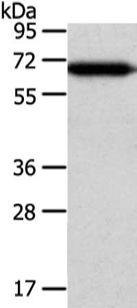 CSB-PA157844