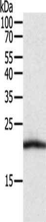 CSB-PA268599 WB