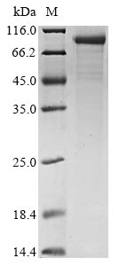 CSB-EP003657HU