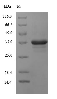 CSB-EP006325HU1