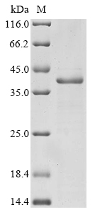 CSB-EP011891HU2