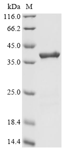 CSB-EP013032HU