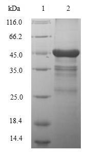 CSB-EP014659HU