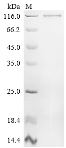 CSB-EP015759HU