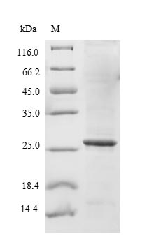 CSB-EP021581HU