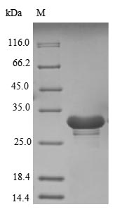 CSB-EP714018HU1a0