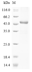 CSB-EP822774HU
