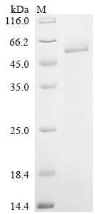 CSB-EP889106HU