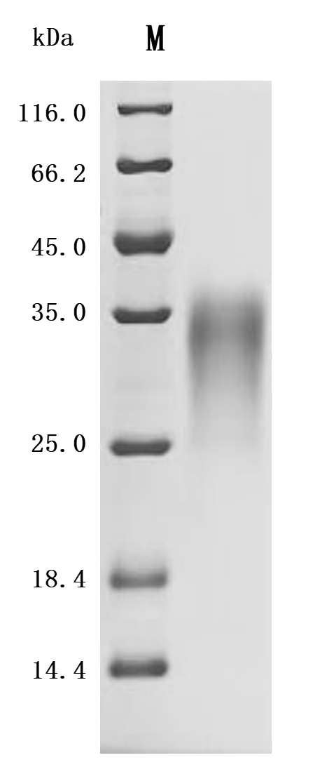 CSB-MP001261MO1