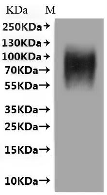 CSB-MP001392HU(M)