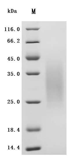 CSB-MP004957HU1