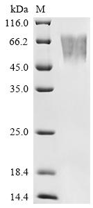 CSB-MP006235HU-B