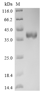 CSB-MP882142HU2 SDS-PAGE
