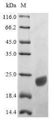 CSB-EP001933HU