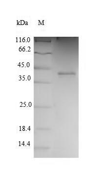 CSB-EP005061HU