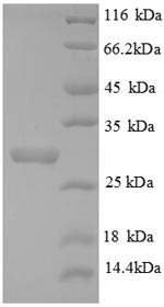 CSB-EP005743HU