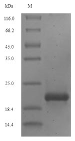 CSB-EP007779HU
