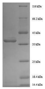 CSB-EP009344HU