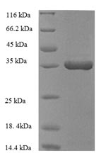 CSB-EP010583HU