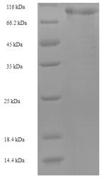 CSB-EP013508HU