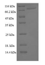 CSB-EP018424HU