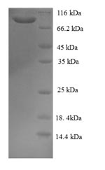 CSB-EP846598HU