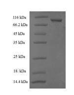 CSB-EP856967HU