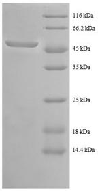 CSB-RP043554h